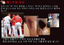 햄스트링 PPT 4페이지