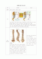 간호사정 사정도구 OS case - Spinal stenosis, lumbar region  13페이지