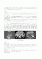 case study(HCC) 4페이지