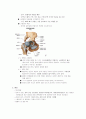case study - coxarthrosis, THA 3페이지