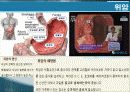 암의 종류 및 동맥스텐트시술에 대하여.ppt 4페이지
