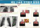 암의 종류 및 동맥스텐트시술에 대하여.ppt 7페이지