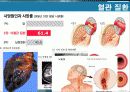 암의 종류 및 동맥스텐트시술에 대하여.ppt 9페이지
