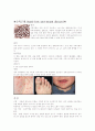 수족구병/광우병/신종 인플루엔자A(H1N1) 내용 정리 2페이지