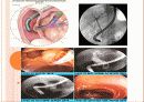 ERCP : 내시경적 역행성 췌담관 조영술 (Endoscopic retrograde cholangiopancreatography) 4페이지