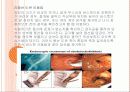ERCP : 내시경적 역행성 췌담관 조영술 (Endoscopic retrograde cholangiopancreatography) 10페이지