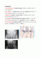 발달성 고관절 탈구 (CONGENITAL AND DEVELOPMENTAL DYSPLASIA OF THE HIP) 2페이지