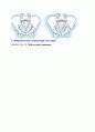 발달성 고관절 탈구 (CONGENITAL AND DEVELOPMENTAL DYSPLASIA OF THE HIP) 8페이지