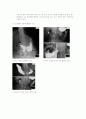 상부 위장관 조영술 (Upper Gastrointestinal, U.G.I series) 3페이지
