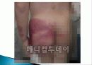 아동학대 대책 4페이지