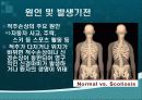 SCI(Spinal Cord Injury : 척수손상) 9페이지