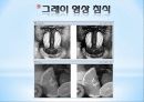Chapter 10. 모폴로지 10페이지
