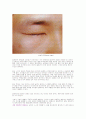 봉합사및 봉합침 5페이지