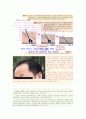 모발의 일생정리 2페이지