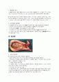 담석증, 담낭염의 병태생리  4페이지