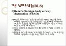 CPR(심폐소생술) 및 intubation 15페이지
