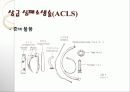 CPR(심폐소생술) 및 intubation 17페이지