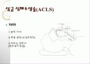 CPR(심폐소생술) 및 intubation 18페이지