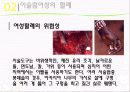 [★우수레포트★][이스람 사회의 여성 분석] 이슬람 여성의 지위, 이슬람 여성의 생활, 명예살인, 이슬람 여성의 할례 등에 대한 발표자료 22페이지
