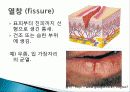 건강사정 -피부, 머리, 목 22페이지