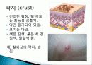 건강사정 -피부, 머리, 목 23페이지