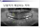 발치 2페이지
