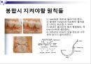 발치 12페이지
