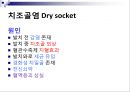 발치 17페이지