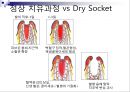 발치 18페이지