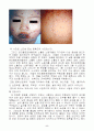 도금작업장에서의 위험성 2페이지