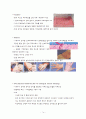 화상 케이스 14페이지