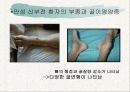 신장의  해부생리와 질환 39페이지
