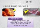 재생의학에서의 양막 4페이지