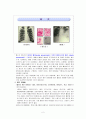 Case 폐렴(bacteria pneumonia) 2페이지