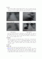 Case 폐렴(bacteria pneumonia) 4페이지