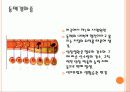 심장병 4페이지