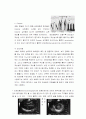 SICU질환명, 주요검사, 약, 의학용어 ( 승모판 협착증,폐색전증,담낭염)  5페이지