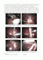 [성인간호학]_수술방_case_Laparoscopic_Cholecystectomy 4페이지