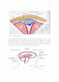 뇌수종(Hydrocephalus)과 V-P shunt 수술 6페이지