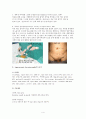 탈장(hernia)과 탈장교정술(Herniorrhaphy)  4페이지