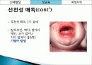 성교육,피임,콘돔,매독,마케팅,브랜드,브랜드마케팅,기업,서비스마케팅,글로벌,경영,시장,사례,swot,stp,4p 18페이지