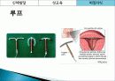 성교육,피임,콘돔,매독,마케팅,브랜드,브랜드마케팅,기업,서비스마케팅,글로벌,경영,시장,사례,swot,stp,4p 46페이지