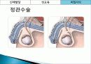 성교육,피임,콘돔,매독,마케팅,브랜드,브랜드마케팅,기업,서비스마케팅,글로벌,경영,시장,사례,swot,stp,4p 53페이지
