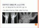손목,손,손가락손상재활 4페이지