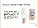 손목,손,손가락손상재활 21페이지
