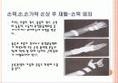손목,손,손가락손상재활 22페이지