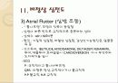심전도의 이해 35페이지