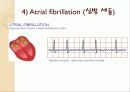 심전도의 이해 38페이지