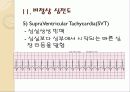 심전도의 이해 39페이지