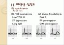 심전도의 이해 56페이지